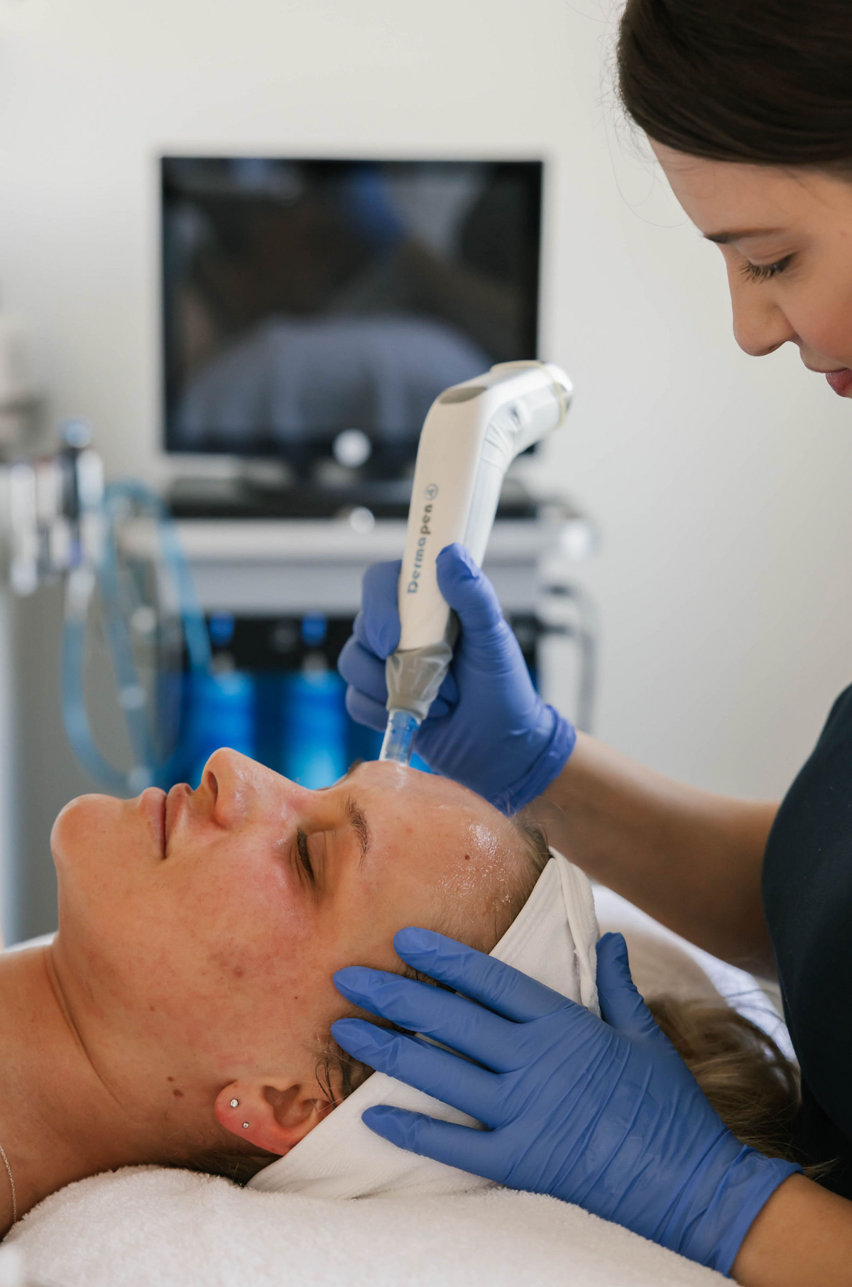 Medical grade microneedling at View Laser in Tsawwassen, BC
