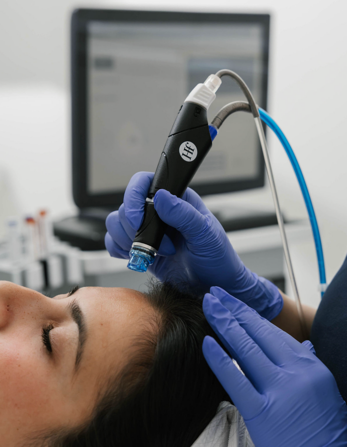 HydraFacial MD at View Laser in Tsawwassen, BC