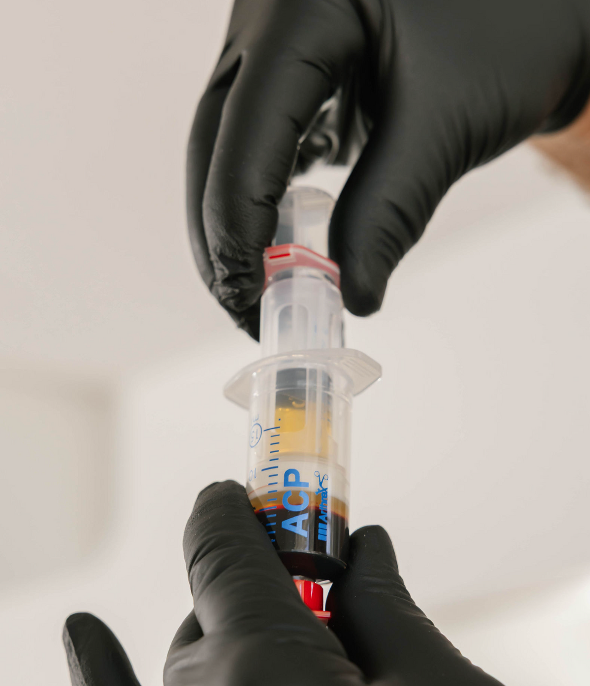 PRP and PRF treatments at View Laser in Tsawwassen, BC