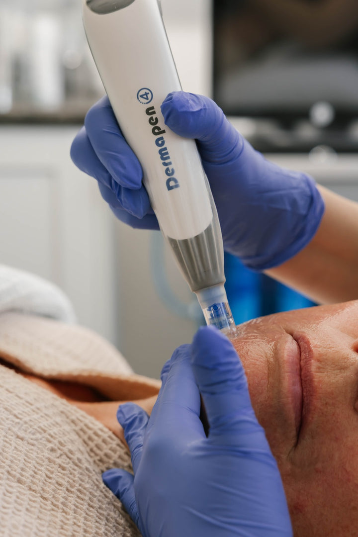 Microneedling with VAMP Package